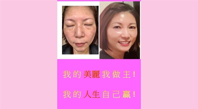 相關圖片