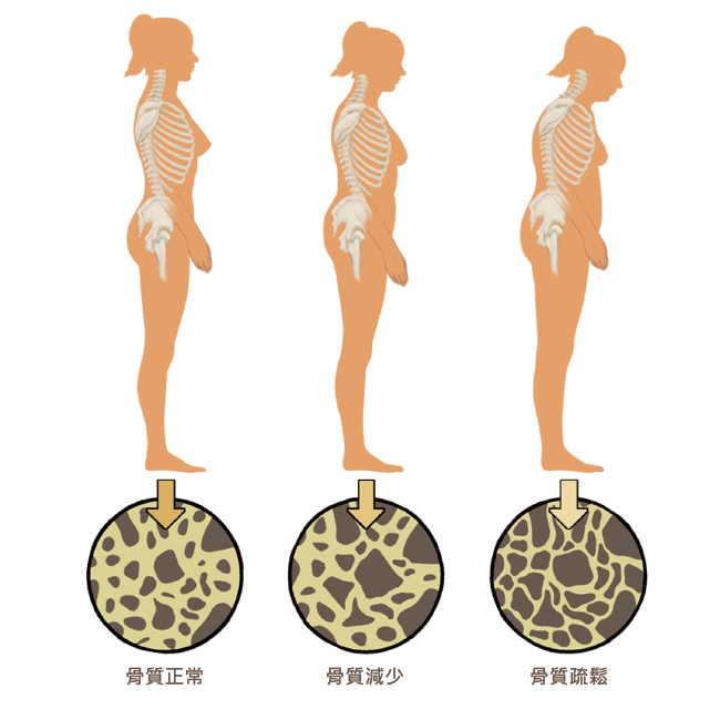 相關圖片